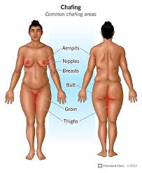 Image result for sore skin in the groin area