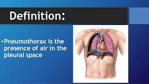 Depending on the cause of the pneumothorax, a second goal may be to prevent recurrences. Pin On New