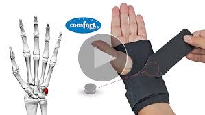 Ulnar Impingement Syndrome | Radiology Reference Article | Radiopaedia.Org
