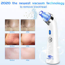 We did not find results for: Best Blackhead Remover On 2020 A Complete Buyer S Guide