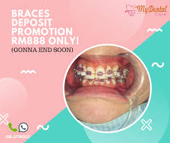 Check spelling or type a new query. Klinik Gigi My Dental Care Puchong Facebook