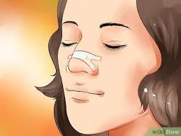 On attaching a breathe right strip on your nose, its lifting effect opens your nose immediately. How To Put On A Breathe Right Strip 6 Steps With Pictures