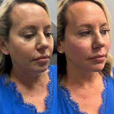 Erin Clouser RN,BSN (@erin_clouser_injects) • Instagram photos and videos