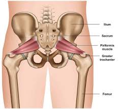 It seems to be more common among women though the reason for this is not known. How To Heal From Piriformis Syndrome As Quickly As Possible