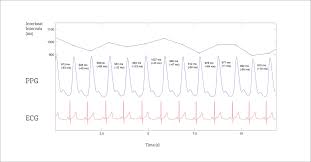 How To Measure Heart Rate Variability Oura Hrv Tracking