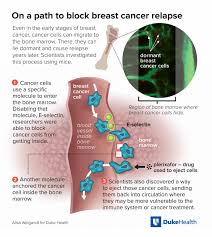 As the cancerous plasma cells fill the bone marrow, you are not able to make enough normal blood cells. Cancer S Spread To Bone National Cancer Institute