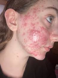 Mahdad Michael MD, 17822 Beach Blvd, Ste 419, Huntington Beach, CA 92647,  US