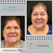 QUALITY DENTURE AND IMPLANT CENTER