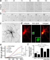 We did not find results for: Small Molecule G Quadruplex Stabilizers Reveal A Novel Pathway Of Autophagy Regulation In Neurons Elife