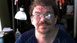 Introduction and Experiences with Neurofibromatosis Type 1