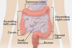 Man shares story of stage 4 colon cancer at 23. Basic Information About Colorectal Cancer Cdc