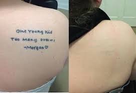 We are a locally owned and operated medical spa and aesthetic practice, offering the latest and best. Vamoose Tattoo Removal Moves Into Former Bay View Tattoo Shop