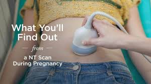 Nt Scan What You Ll Find Out