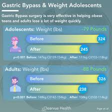 4 Charts Gastric Bypass Effectiveness In Adults Teens