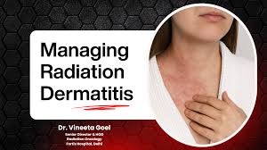 Image result for Radiation Dermatitis
