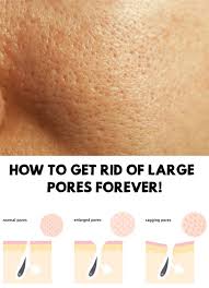 What can i do about the open pores on my nose and face? Pin On Beauty