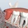 Tandarts Dental Surgery from dentalsurgeryvirginia.com