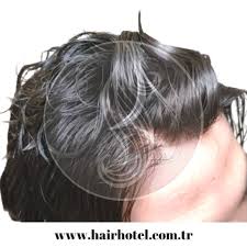 Dogal Protez Sac Modelleri Sac Dogal