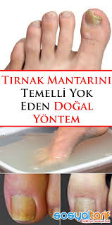 Tirnak Mantarini Temelli Yok Eden Dogal Yontem Health Advice Health Detox