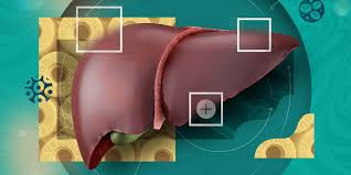 Image result for Liver Function Test Abnormality