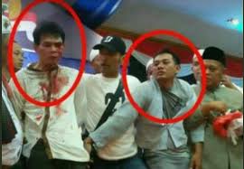 How much of alwi assegaf's work have you seen? Salah Percobaan Pembunuhan Terhadap Habib Alwi Abdurahman Assegaf Turnbackhoax