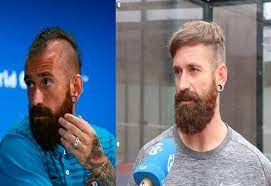 Cenk tosun 7 haziran 1991 doğumlu, profesyonel türk futbolcudur. 8 Football Players Who Had Hair Transplantation Cosmeticium