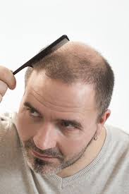 Find the best hairstyles & haircuts for balding men here. Haircuts For Men Going Bald Male Baldness Can Start At An Early Age By Emma Kalman Medium
