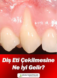 Omer Kurt Adli Kullanicinin Saglik Panosundaki Pin Dogal Saglik Saglikli Tatli Tarifleri Saglikli Yasam Tarzi