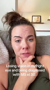 Multiple Sclerosis and Eye Twitch