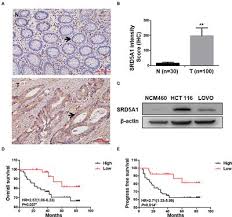 Eine prävention des prostatakarzinoms … Frontiers Steroid 5a Reductase Type I Induces Cell Viability And Migration Via Nuclear Factor Kb Vascular Endothelial Growth Factor Signaling Pathway In Colorectal Cancer Oncology