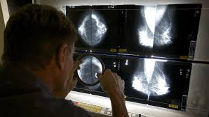 Another canadian study found a 52 percent increase in breast cancer mortality in young women given annual mammograms. Mammograms Find Many Tumors That May Not Need Treatment Shots Health News Npr