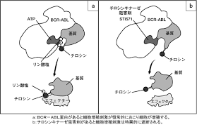 Cml の症状は進行性で、 慢性期 → 移行期 →急性転化期と段階的に悪性度が進行します。. æ…¢æ€§éª¨é«„æ€§ç™½è¡€ç—… æ¨™æº–åŒ»ç™‚æƒ…å ±ã‚»ãƒ³ã‚¿ãƒ¼
