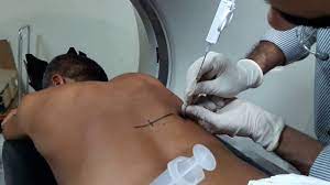 Lung Biopsy Is One Of The Procedures Used To Diagnose Ipf