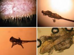 Image result for Demodex brevis