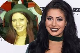 Her birth place is in newcastle upon she has also had several other surgeries including an eyebrow lift, nose job, lip fillers, dermal cheek fillers, dental veneers, as well as botox surgery. Chloe Ferry Says She Doesn T Miss Her Old Face And She Hates The Natural Look Mirror Online