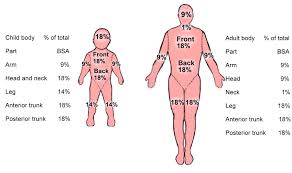 Unbiased Rule Of 9 For Burn Rule Of Nines Diagram Body