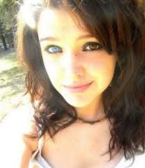 Two different colored eyes