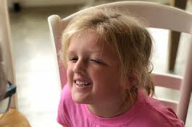 National Foundation for Ectodermal Dysplasias