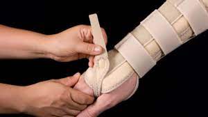 Die Distale Radiusfraktur Der Handgelenksbruch Fitness Sportmedizin Sportverletzung