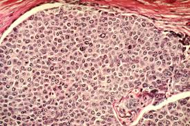 Where did you come from? Cancer Cell Wikipedia