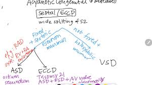 Image result for Endocardial Cushion Defect