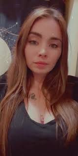 Now I need gingivoplasty surgery i cant afford 🥲 #receededgum #fypシ #...