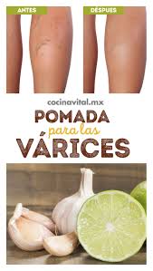 Doris Bracho (doryenvic)