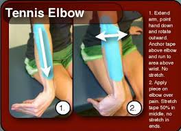 Resources Rock Tape Taping Rehab Kinesiology Taping Tennis Elbow Kinesio Taping