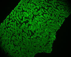 This technique can be utilized to visualize the. Sanjay Mukhopadhyay On Twitter 21 Direct Immunofluorescence Is Performed On Tissue Indirect Immunofluorescence Uses Patient S Serum Here S The Scoop From Master Educator Sgottesmanmd Silvipearls Https T Co Emtftgtnbo