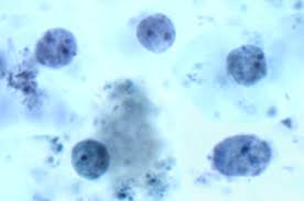 Examine the slide with your microscope starting at 40x. Intestinal Protozoa