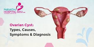Image result for Cyst
