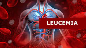 La leucemia aguda exige un tratamiento oportuno y agresivo. Leucemia Megalabs
