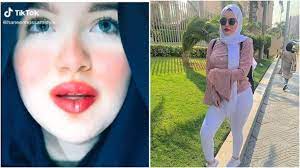 بدأت حنين حسام الطالبة بكلية الآثار بجامعة القاهرة بتصوير فيديوهات على موقع تيك توك وبعد شهرتها عليه بدأت بتصوير فيديوهات رقص على مواقع التواصل الاجتماعي الانستجرام والفيسبوك. ØªØ·ÙˆØ±Ø§Øª Ø¬Ø¯ÙŠØ¯Ø© ÙÙŠ Ø£Ø²Ù…Ø© Ø§Ù„Ù…ØµØ±ÙŠØ© Ø­Ù†ÙŠÙ† Ø­Ø³Ø§Ù…