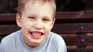 What Causes Autism? Rare Mutation In The CHD8 Gene May Be Responsible For  Autism Subtype